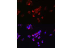 Immunofluorescence analysis of HepG2 cells using FGF23 antibody (ABIN6127894, ABIN6140600, ABIN6140602 and ABIN6221721) at dilution of 1:25. (FGF23 抗体  (AA 25-251))