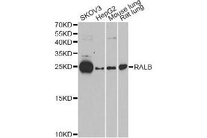 Western blot analysis of extracts of various cell lines, using RALB antibody (ABIN6293713) at 1:1000 dilution. (RALB 抗体)