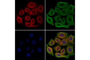 ABIN6260578 and ABIN6278244 staining Hela cells by IF/ICC.