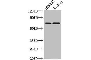 Western Blot Positive WB detected in: HEK293 whole cell lysate, Mouse kidney tissue All lanes: RABGGTA antibody at 1. (RABGGTA 抗体  (AA 1-200))