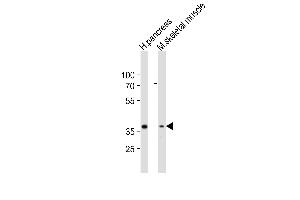 Western blot analysis of lysates from human pancreas, mouse skeletal muscle tissue lysate (from left to right), using B4GALT7 Antibody (C-term) (ABIN6243577 and ABIN6577900). (B4GALT7 抗体  (C-Term))