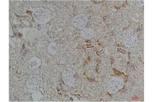 Immunohistochemistry (IHC) analysis of paraffin-embedded Rat KidneyTissue using Kir4. (KCNJ10 抗体)