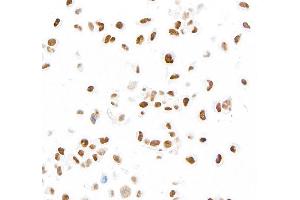 Immunocytochemistry (ICC) image for anti-MutS Homolog 6 (E. Coli) (MSH6) (AA 1310-1360) antibody (ABIN7455152)