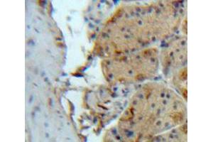 Used in DAB staining on fromalin fixed paraffin-embedded Stomach tissue (SIRT2 抗体  (AA 65-340))
