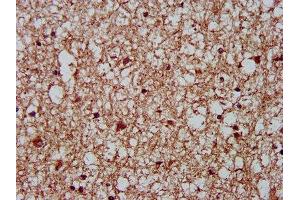 IHC image of ABIN7149368 diluted at 1:400 and staining in paraffin-embedded human brain tissue performed on a Leica BondTM system. (CKAP5 抗体  (AA 1802-2019))