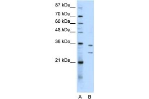 WB Suggested Anti-BXDC5 Antibody Titration:  0. (RPF1 抗体  (N-Term))