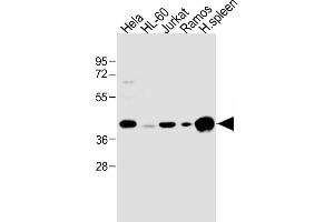 All lanes : Anti-HLA-B Antibody (N-term) at 1:1000 dilution Lane 1: Hela whole cell lysate Lane 2: HL-60 whole cell lysate Lane 3: Jurkat whole cell lysate Lane 4: Ramos whole cell lysate Lane 5: human spleen lysate Lysates/proteins at 20 μg per lane.