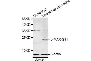 Western blot analysis of extracts of Jurkat cells, using Phospho-MAX-S11 antibody (ABIN5969917) at 1/1000 dilution. (MAX 抗体  (pSer11))