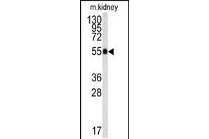 Western blot analysis of anti-ALDH9A1 Antibody in mouse kidney tissue lysates (35ug/lane). (ALDH9A1 抗体  (C-Term))