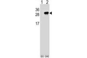 Western blot analysis of Interleukin-28B (arrow) using rabbit polyclonal Interleukin-28B  (N-term): 293 cell lysates (2ug/lane) either nontransfected (Lane 1) or transiently transfected (Lane 2) with the IL28B gene. (IL28B 抗体  (N-Term))