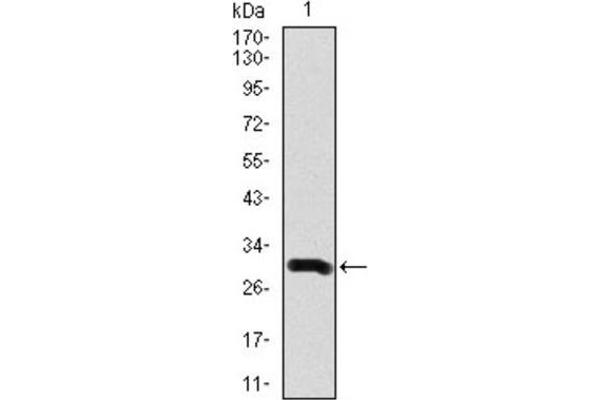Doublecortin 抗体  (AA 362-411)