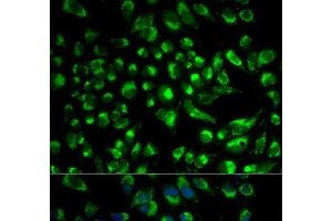 Immunofluorescence analysis of HeLa cells using SPAM1 Polyclonal Antibody (SPAM1 抗体)