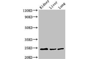 Western Blot Positive WB detected in: Mouse kidney tissue, Mouse liver tissue, Rat lung tissue All lanes: RAB5A antibody at 3 μg/mL Secondary Goat polyclonal to rabbit IgG at 1/50000 dilution Predicted band size: 24, 23 kDa Observed band size: 24 kDa (RAB5 抗体  (AA 1-215))