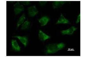 Immunostaining analysis in HeLa cells. (TARS 抗体)