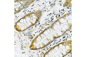 Immunohistochemistry of paraffin-embedded human colon using PGK1 Antibody.