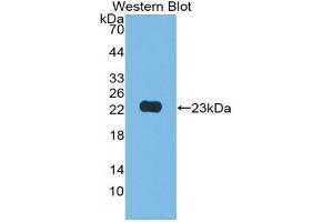 Detection of Recombinant JAM2, Human using Polyclonal Antibody to Junctional Adhesion Molecule 2 (JAM2) (JAM2 抗体  (AA 74-250))