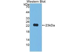 Detection of Recombinant JAM2, Human using Polyclonal Antibody to Junctional Adhesion Molecule 2 (JAM2) (JAM2 抗体  (AA 74-250))