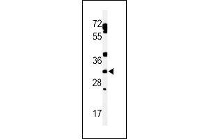 Western blot analysis of lysate from human heart tissue lysate, using TBCD7 Antibody (Center) (ABIN653858 and ABIN2843117). (TBC1D7 抗体  (AA 150-179))