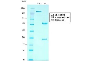 SDS-PAGE Analysis of Purified GPC3 Mouse Recombinant Monoclonal Antibody ABIN6383809. (Recombinant Glypican 3 抗体)