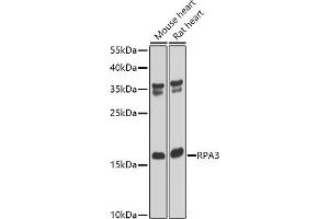 Western blot analysis of extracts of various cell lines, using RP antibody (ABIN6128655, ABIN6147086, ABIN6147088 and ABIN6222439) at 1:1000 dilution. (RPA3 抗体  (AA 6-121))