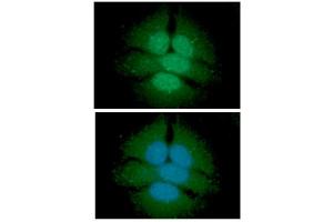 ICC/IF analysis of UGDH in HeLa cells line, stained with DAPI (Blue) for nucleus staining and monoclonal anti-human UGDH antibody (1:100) with goat anti-mouse IgG-Alexa fluor 488 conjugate (Green). (UGDH 抗体)