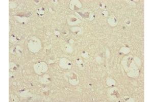 Immunohistochemistry of paraffin-embedded human brain tissue using ABIN7147410 at dilution of 1:100 (CEP57 抗体  (AA 1-240))