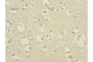Immunohistochemistry of paraffin-embedded human brain tissue using ABIN7147410 at dilution of 1:100 (CEP57 抗体  (AA 1-240))