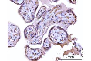 IHC analysis of RRP1 using anti-RRP1 antibody (ABIN7600683). (RRP1 抗体  (AA 22-237))