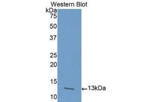 Western Blotting (WB) image for anti-Activin A Receptor, Type IB (ACVR1B) (AA 24-126) antibody (ABIN1175506) (Activin A Receptor Type IB/ALK-4 抗体  (AA 24-126))