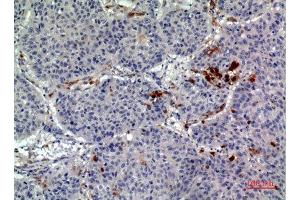 Immunohistochemistry (IHC) analysis of paraffin-embedded Human Lung, antibody was diluted at 1:100.