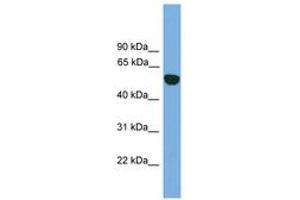 Image no. 1 for anti-Epoxide Hydrolase 1, Microsomal (Xenobiotic) (EPHX1) (AA 35-84) antibody (ABIN6745051) (EPHX1 抗体  (AA 35-84))