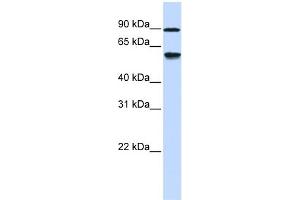 WB Suggested Anti-ADHFE1 Antibody Titration: 0. (ADHFE1 抗体  (Middle Region))