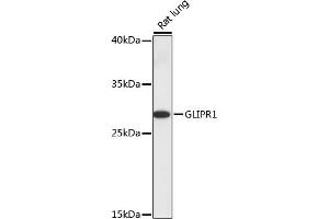 Western blot analysis of extracts of rat lung, using GLIPR1 antibody (ABIN7267387) at 1:1000 dilution. (GLIPR1 抗体  (AA 22-140))