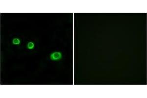 Immunofluorescence analysis of MCF7 cells, using GBP1 Antibody. (GBP1 抗体  (AA 71-120))