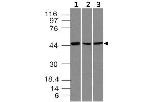 Image no. 1 for anti-SRY (Sex Determining Region Y)-Box 11 (SOX11) (AA 23-236) antibody (ABIN5027536) (SOX11 抗体  (AA 23-236))