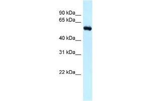 WB Suggested Anti-Rbbp5 Antibody Titration: 1. (RBBP5 抗体  (N-Term))