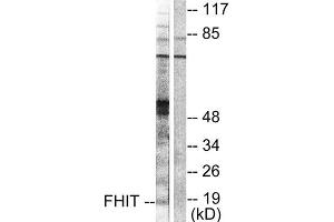 Western Blotting (WB) image for anti-Fragile Histidine Triad (FHIT) (Internal Region) antibody (ABIN1848544) (FHIT 抗体  (Internal Region))