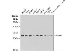 Western blot analysis of extracts of various cell lines using PSMA6 Polyclonal Antibody at dilution of 1:1000. (PSMA6 抗体)