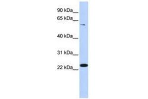 Image no. 1 for anti-Zinc Finger Protein 460 (ZNF460) (AA 36-85) antibody (ABIN6741086) (ZNF460 抗体  (AA 36-85))