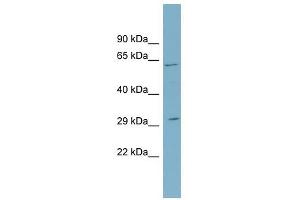 Western Blotting (WB) image for anti-Steroid-5-alpha-Reductase, alpha Polypeptide 2 (3-Oxo-5 alpha-Steroid delta 4-Dehydrogenase alpha 2) (SRD5A2) (N-Term) antibody (ABIN635902)