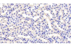 Immunohistochemistry (IHC) image for anti-Follistatin-Like 3 (Secreted Glycoprotein) (FSTL3) (AA 24-256) antibody (ABIN7436606)