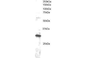 Image no. 1 for anti-Dickkopf Homolog 4 (Xenopus Laevis) (DKK4) (C-Term) antibody (ABIN374183) (DKK4 抗体  (C-Term))