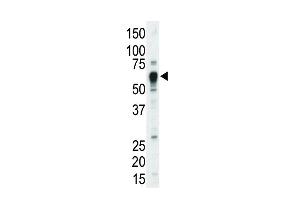 Western Blotting (WB) image for anti-Nuclear Receptor Subfamily 4, Group A, Member 3 (NR4A3) (AA 175-205) antibody (ABIN392111)