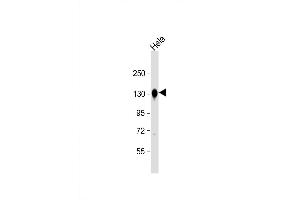Western Blot at 1:8000 dilution + Hela whole cell lysate Lysates/proteins at 20 ug per lane. (Cadherin 抗体  (C-Term))