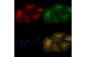 ABIN6257106 and ABIN6275018 staining  cells by IF/ICC. (CLDN8 抗体  (C-Term))