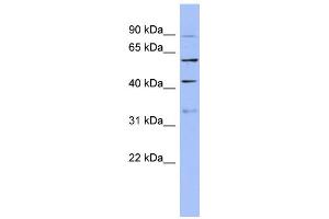 WB Suggested Anti-PRPF4 Antibody Titration:  0. (PRPF4 抗体  (N-Term))