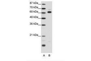 Image no. 1 for anti-Thyroid Hormone Receptor Interactor 4 (TRIP4) (AA 191-240) antibody (ABIN202787) (TRIP4 抗体  (AA 191-240))