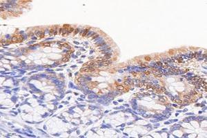 Immunohistochemistry analysis of paraffin-embedded rat colonitis using,FGF10 (ABIN7073940) at dilution of 1: 8000 (FGF10 抗体)