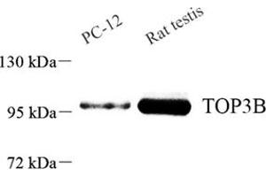 Western blot analysis of TOP3B (ABIN7075940) at dilution of 1: 800 (TOP3B 抗体)