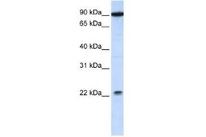 TMTC4 antibody used at 1 ug/ml to detect target protein. (TMTC4 抗体  (C-Term))